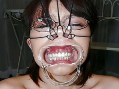 Facial torment