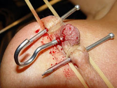 Nipples in pain